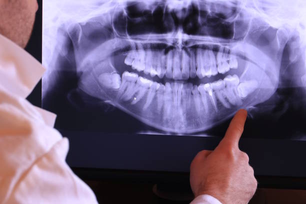 Best Emergency Dental Services for Seniors in New Haven, IN